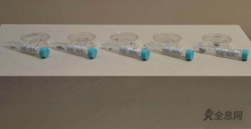 四川：营盘山遗址：一颗牙齿见证文明起源交流