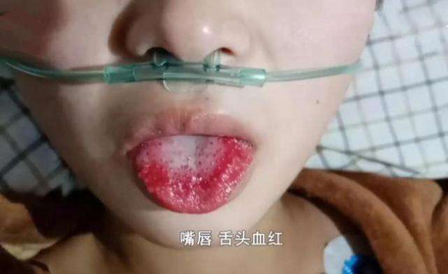 18岁女孩被姐夫投毒百草枯，百草枯是剧毒致死率100%