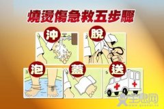 烧伤自救