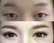 全班都是双眼皮，整容开始低龄化？