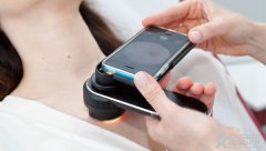 智能手机APP能检测皮肤癌