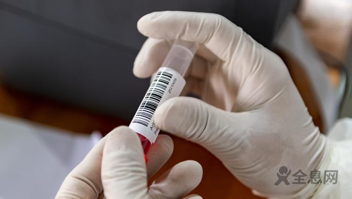 瑞丽重启为何这么难