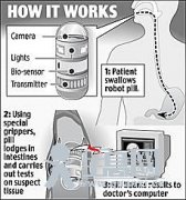 英国发明药片机器人可入腹检查癌症